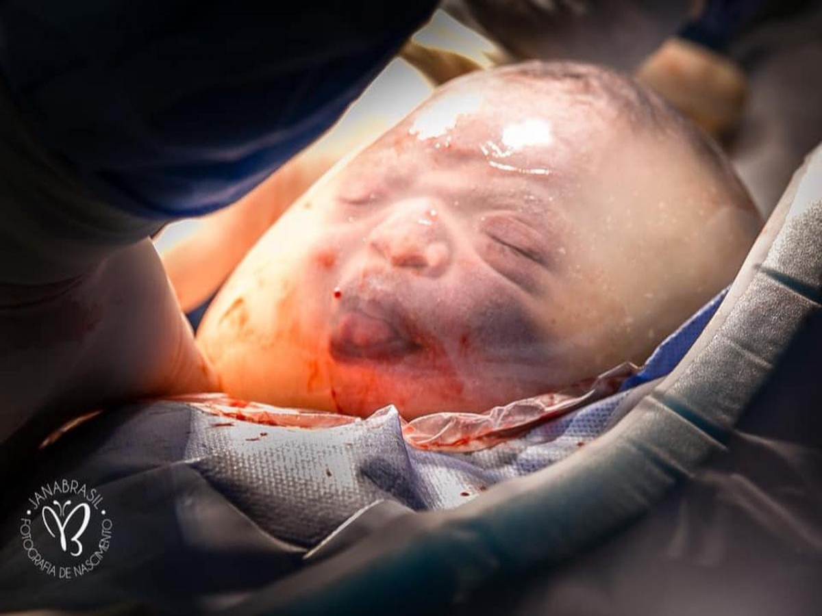 'Ganhei um presente embalado', diz mãe de bebê que nasceu dentro da bolsa amniótica