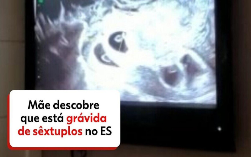 VÍDEO: Mãe descobre que está grávida de sêxtuplos Fui na consulta só para ver 1 bebê